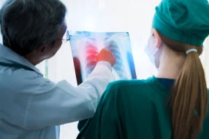 צילום רנטגן - סרטן ריאות גרורתי